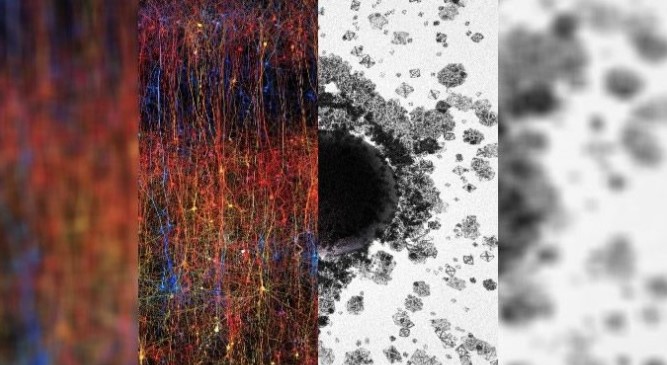 Ученые обнаруживают "вселенная многомерная" в человеческом мозгу